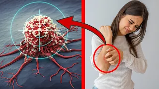 12 Common Symptoms of CANCER you should NEVER ignore 💥 (IMPORTANT) 🤯