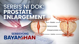 Ano ang pwedeng inumin para malunasan ang prostate enlargement?