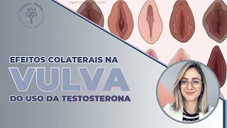 Efeitos Colaterais na Vulva do uso da Testosterona