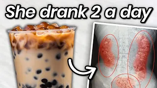 A Girl Drank 2 Bubble Teas A Day, This Is How Her Body Shut Down