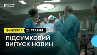 Дезінфікують криниці, операція на серці, «Останній шлях Кобзаря», показова годівля | 22.05.23