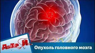 Опухоль головного мозга | Доктор И