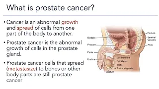 Prostate Cancer Overview