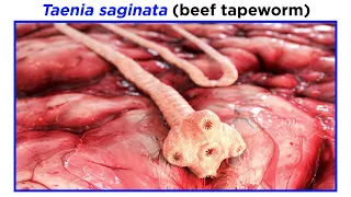 Phylum Platyhelminthes Part 4:  Tapeworms of Class Cestoda