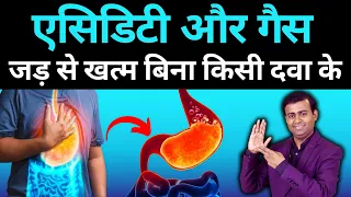 एसिडिटी और गैस का 100% असरदार इलाज बिना किसी दवा के   Treat Acidity & Gas Naturally #acidity