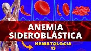 ANEMIA SIDEROBLÁSTICA (FISIOPATOLOGIA-SINTOMAS-DIAGNOSTICO-TRATAMENTO) | HEMATOLOGIA