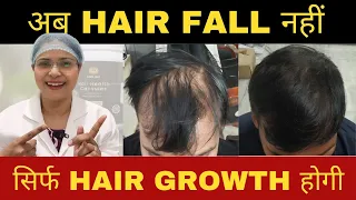 100 गुना बाल बढ़ेंगे इस तरह | यह तरीका फैल नहीं होता #hair #trending #hairfall