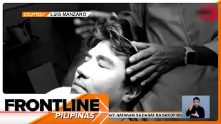 Luis Manzano, nagpa-biopsy nang may makapang lumalaking umano'y nunal sa ulo | Frontline Pilipinas