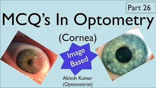 MCQ’s in Optometry | Cornea | Diseases of Cornea | Part 26