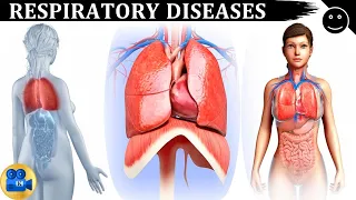 Respiratory Diseases: Causes, Diagnosis and Treatment