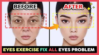 ✨ EYES EXERCISE to Reduce dark circles, Wrinkles, Bags under the eyes, Tear Troughs, Droopy eyelids