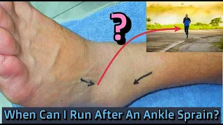 When Can I Run Again After an Ankle Sprain?