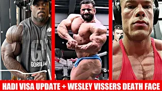 Hadi Choopan Visa/ Physique Update + Brandon Curry's Best Update Yet + Wesley Vissers SHREDDED ASF