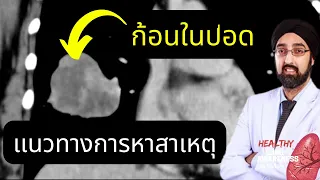 ก้อนในปอด | สิ่งที่คุณต้องรู้ | นพ.วินัย โบเวจา