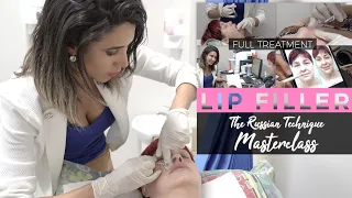 Advanced RUSSIAN Lip Filler Techniques | Full Treatment with Before and After 💋💉