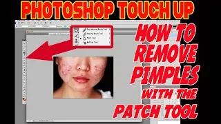 Photoshop how to remove pimples