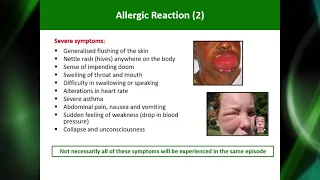 Allergen training video - English