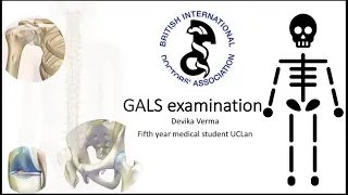 BIDA-SW OSCE Webinar Series - Examination of gait, arms, legs, spine (GALS)