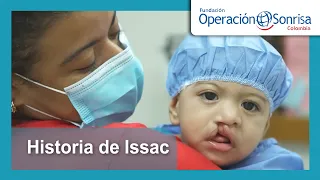 Historia de Issac – Operación Sonrisa Colombia