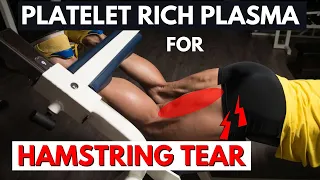 Platelet Rich Plasma For Hamstring Tear | PRP Hamstring Injury