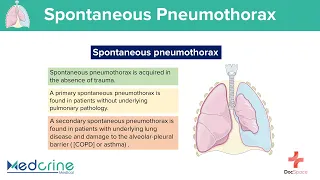 Spontaneous Pneumothorax: Causes, Clinical features, Pathophysiology and Diagnosis