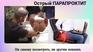 Острый парапроктит. Ни самому посмотреть, ни другим показать.