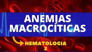 ANEMIAS MACROCÍTICAS - HEMATOLOGIA - AULA 2