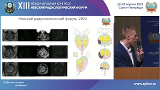 АКТУАЛЬНЫЕ ВОПРОСЫ ЛУЧЕВОЙ ДИАГНОСТИКИ В ОНКОЛОГИИ:СЛОВО «МОЛОДОМУ УЧЕНОМУ»