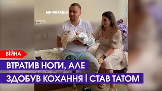 «Я не хочу, щоб мене боялися», – військовий, який втратив ноги на війні