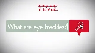 What Are Eye Freckles? | Health