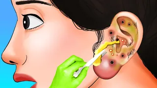 [ASMR] Ear Treatment, Blackhead Removal, Sebum | ASMR Animation