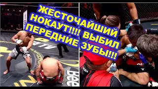 ЖЕСТОЧАЙШИЙ НОКАУТ!!! ВЫБИЛ ПЕРЕДНИЕ ЗУБЫ!!!