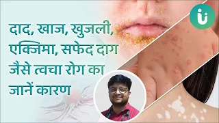 दाद, खाज, खुजली, एक्जिमा, सफेद दाग होने का कारण क्या है जानें Dr. Ayush Pandey से