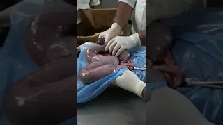 C- section in a bitch with five dead puppies at District Veterinary Hospital Adilabad