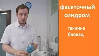 Фасеточный синдром остеохондроза