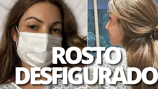 ROSTO DESF1GURADO e RISCO de M0RTE: o drama da apresentadora Patrícia Poeta