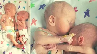 Doctor places a healthy baby next to dying twin and what happened left everyone horrified