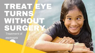 Treatment for eye turns without surgery | Vision Therapy for Esotropia