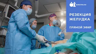 Резекция желудка Прямой эфир операции