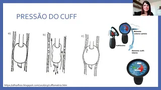 Cuidados com o Cuff do Tubo Endotraqueal