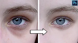 Remove dark circles under eyes | Photoshop Tutorial