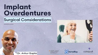 Dental Treatment: Implant Overdentures | Apr 3, 2023