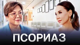 Как жить с ПСОРИАЗОМ и как лечить эту болезнь?