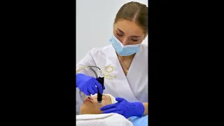 Процедура HydraFacial в клініці Vivamedical Aesthetic Club