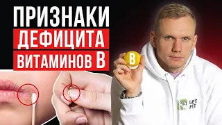 Симптомы и признаки нехватки витаминов группы B! / Как проявляется дефицит витаминов Б?