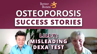 Osteoporosis Success Stories — Lilly Builds Bone Even When DEXA Test Says Otherwise