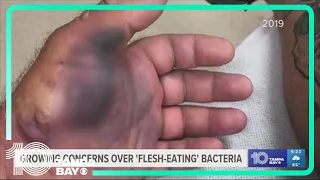 Growing concerns over 'flesh-eating' bacteria in Tampa Bay