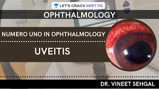 Numero Uno in Ophthalmology: Uveitis | NEET-PG 2021 | Vineet Sehgal