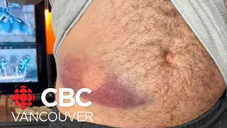 Vancouver police shoot man twice with rubber bullets in case of mistaken identity