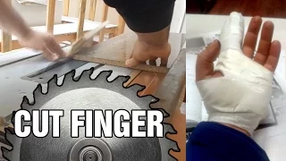 Cut my Finger with Table Saw!!! - tezgah testerede parmağımı kestim!!!